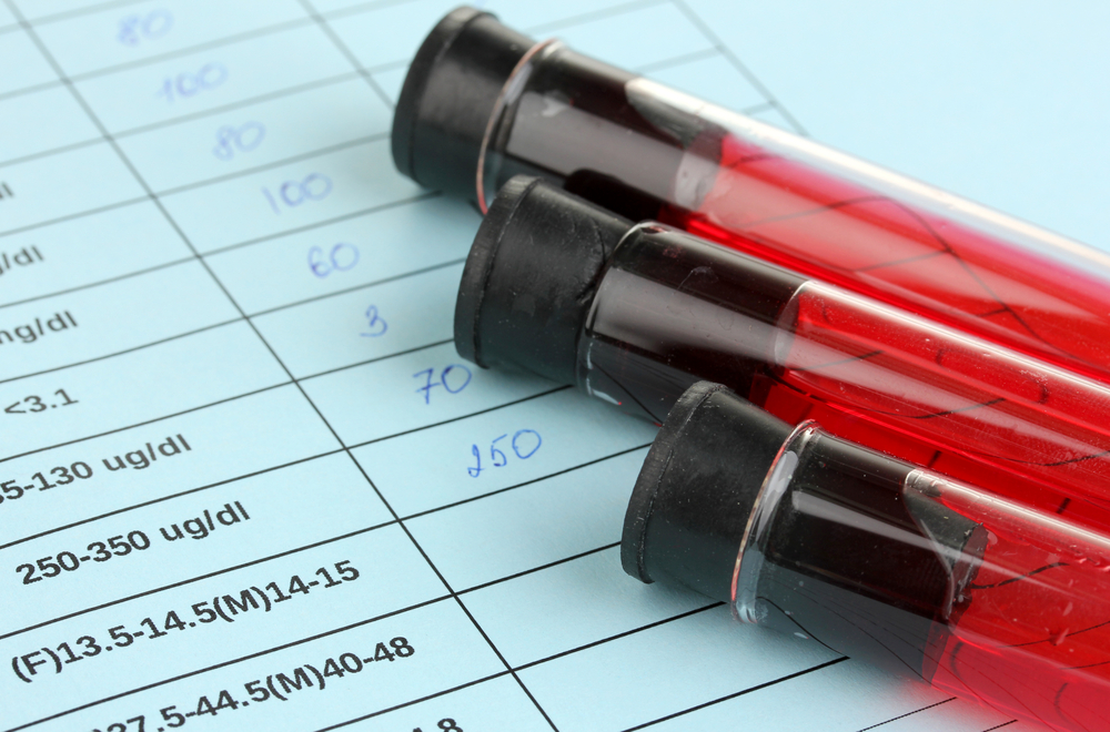 Liver Cancer Test and screening
